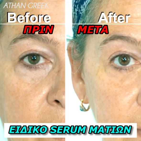 Peptides & HyaluronicAcid Serum Ορός με Υαλουρονικό Οξύ για την Περιοχή των Ματιών